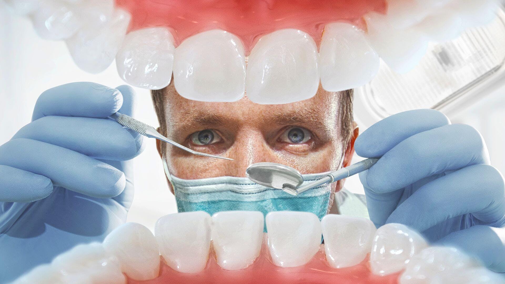 Чем опасен зубной налет и как эффективно с ним бороться
